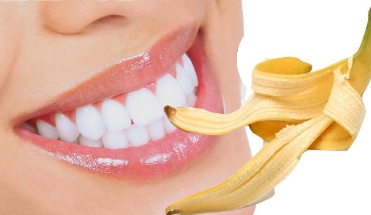 Dùng Vỏ Chuối để tẩy ố vàng răng