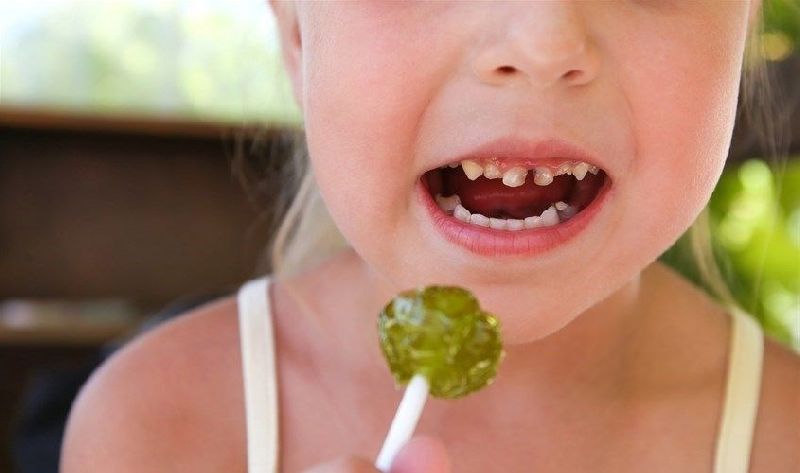 Em bé ăn kẹo dễ bị sâu răng vì một số lý do chính liên quan đến đường trong kẹo và vệ sinh răng miệng chưa tốt.