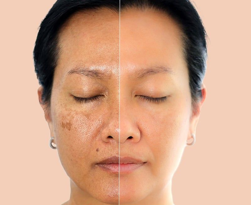 Điểm danh những loại nước ép tốt cho da dễ thực hiện tại nhà