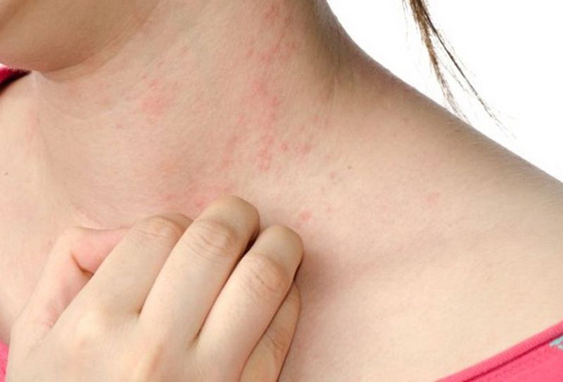 Mặc dù hạt bí đỏ là thực phẩm tự nhiên và lành tính với phần lớn mọi người, nhưng vẫn có một số trường hợp bị dị ứng với các loại hạt, bao gồm cả hạt bí. 