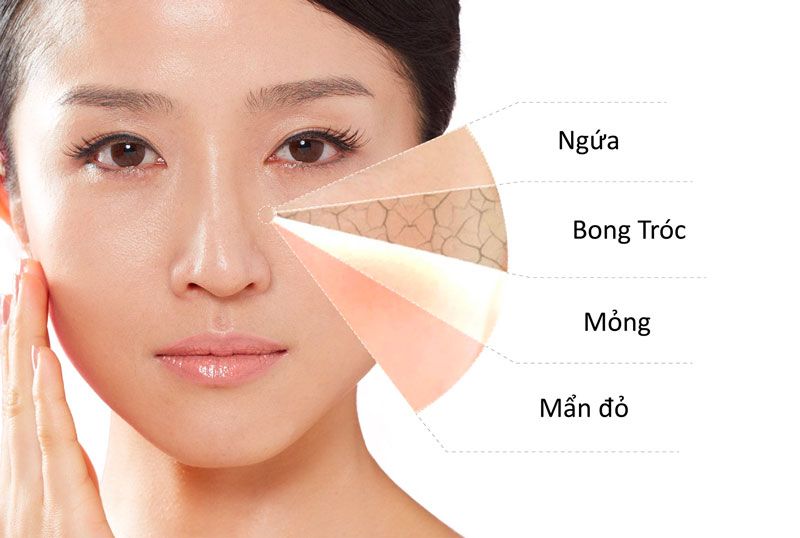 Người mắc bệnh chàm (eczema), viêm da cơ địa, rosacea... dễ bị dị ứng hơn khi sử dụng sản phẩm chứa hóa chất.
